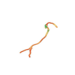 Rotating reconstruction of RCA case 476, colored by radius