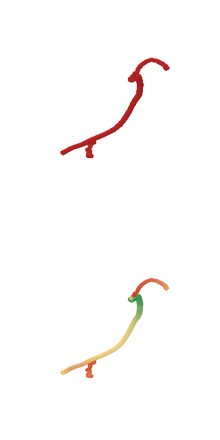 Coarse prediction: red vessel surface above and radius-coloured surface below