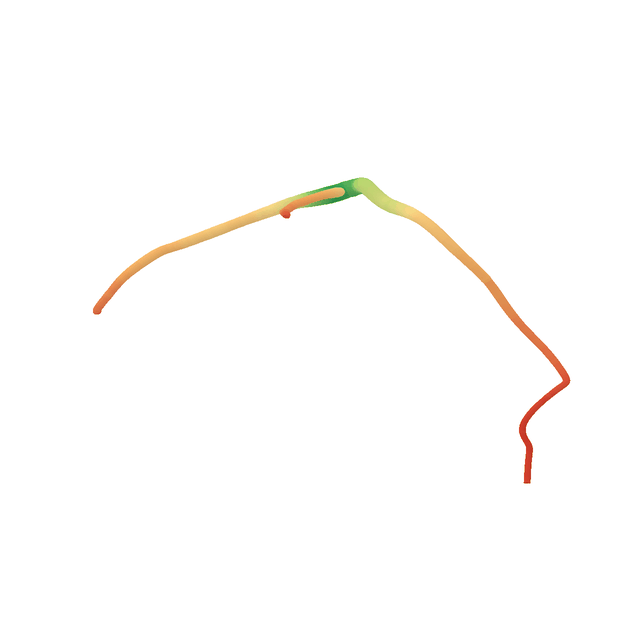 Rotating reconstruction from real X-ray angiography, coloured by radius