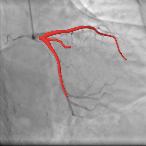 Prediction overlay on real X-ray view 1